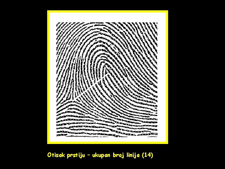 Otisak prstiju – ukupan broj linija (14) 