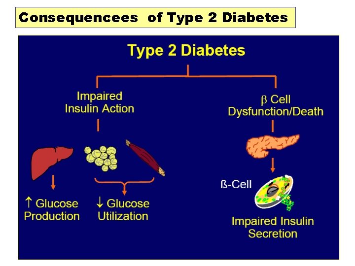 Consequencees of Type 2 Diabetes 29 