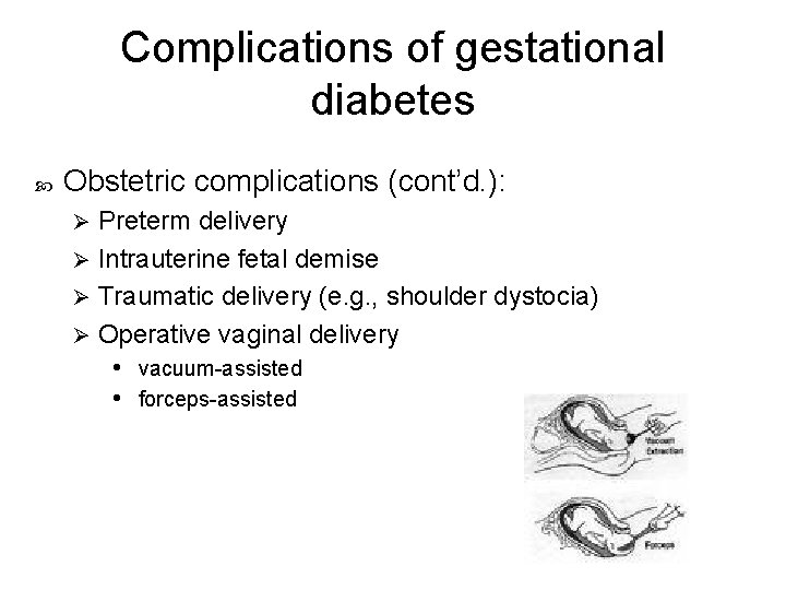 Complications of gestational diabetes Obstetric complications (cont’d. ): Preterm delivery Ø Intrauterine fetal demise