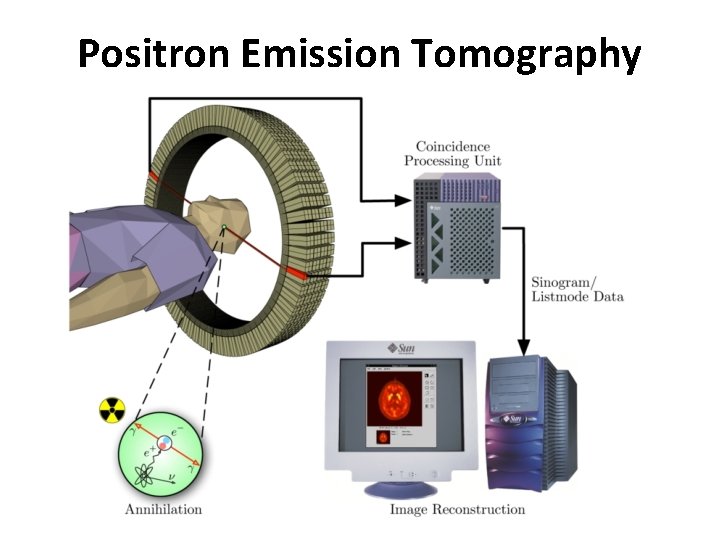 Positron Emission Tomography 
