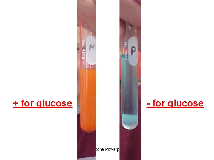 + for glucose - for glucose Saccone Powerpoint 