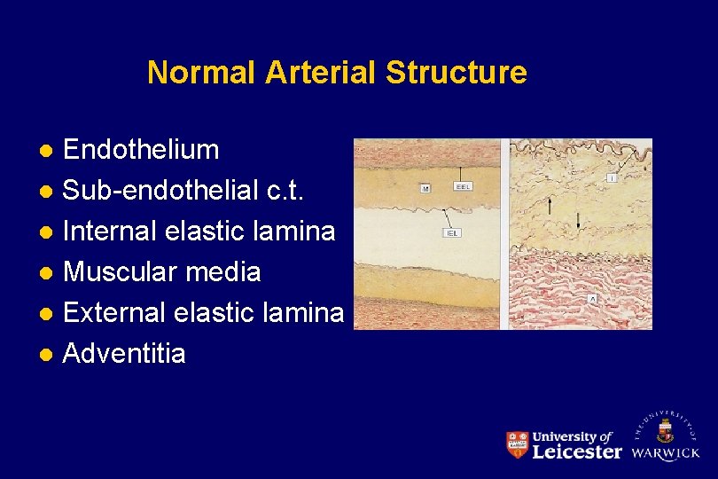 Normal Arterial Structure Endothelium l Sub-endothelial c. t. l Internal elastic lamina l Muscular