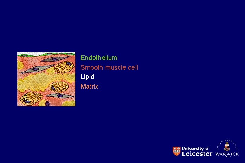 Endothelium Smooth muscle cell Lipid Matrix 