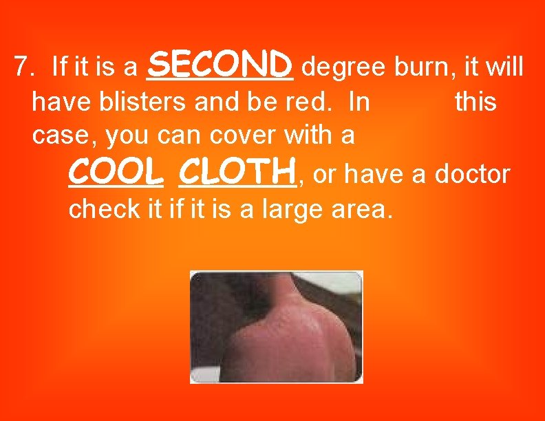 7. If it is a SECOND degree burn, it will have blisters and be