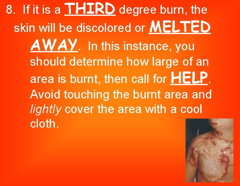 8. If it is a THIRD degree burn, the skin will be discolored or