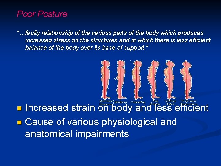 Poor Posture “…faulty relationship of the various parts of the body which produces increased