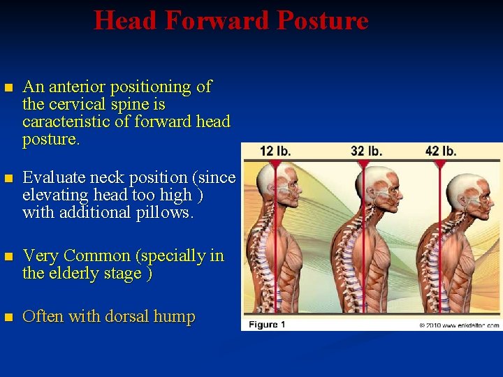 Head Forward Posture n An anterior positioning of the cervical spine is caracteristic of