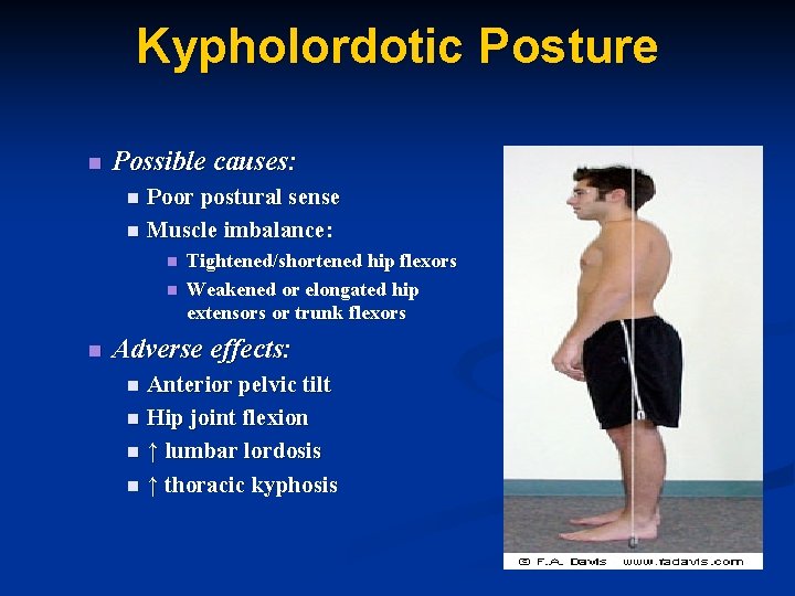 Kypholordotic Posture n Possible causes: Poor postural sense n Muscle imbalance: n n Tightened/shortened