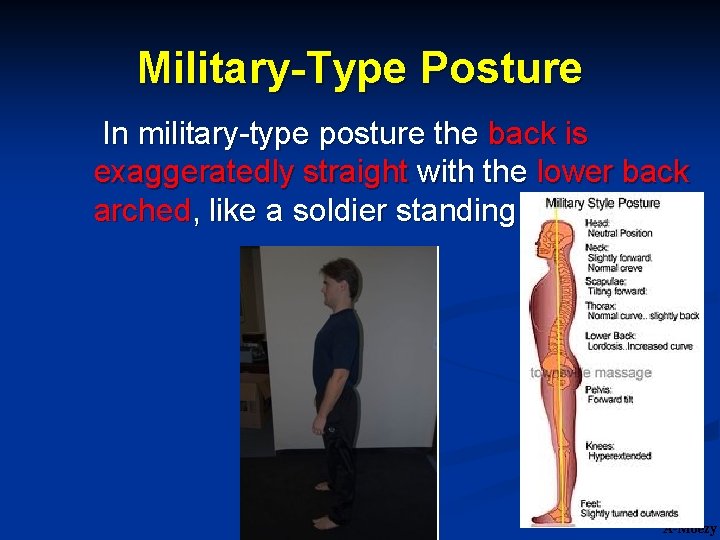 Military-Type Posture In military-type posture the back is exaggeratedly straight with the lower back