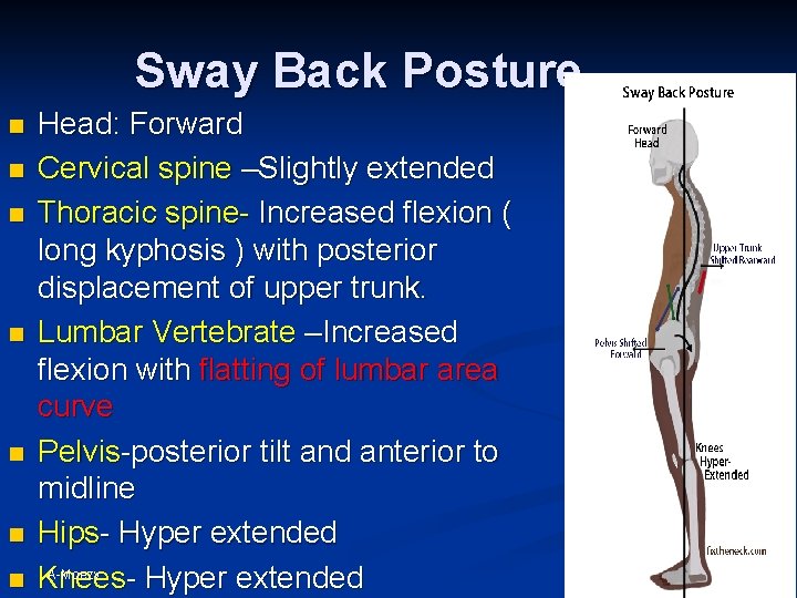 Sway Back Posture n n n n Head: Forward Cervical spine –Slightly extended Thoracic