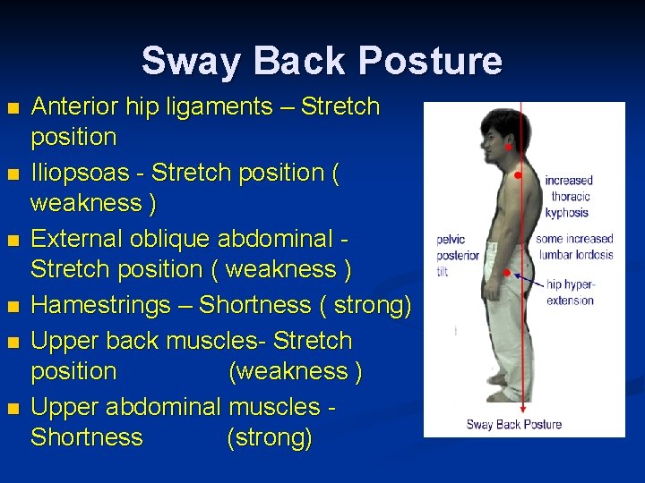 Sway Back Posture n n n Anterior hip ligaments – Stretch position Iliopsoas -