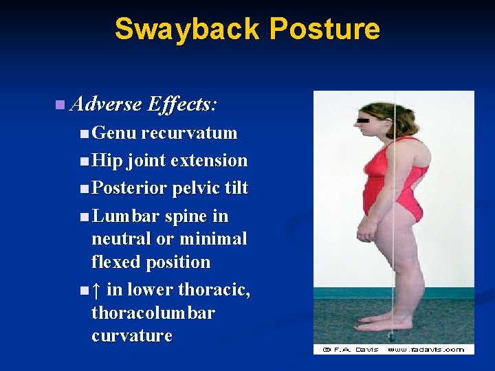 Swayback Posture n Adverse Effects: n Genu recurvatum n Hip joint extension n Posterior