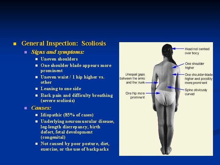 n General Inspection: Scoliosis n Signs and symptoms: n n n Uneven shoulders One