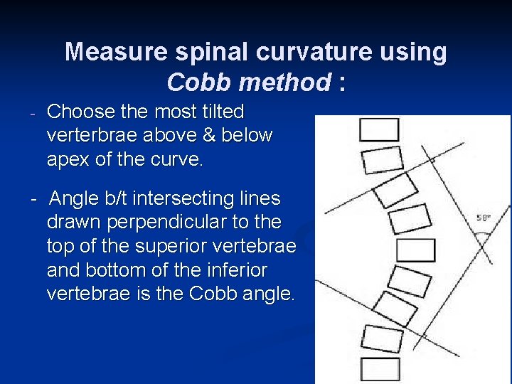 Measure spinal curvature using Cobb method : - Choose the most tilted verterbrae above