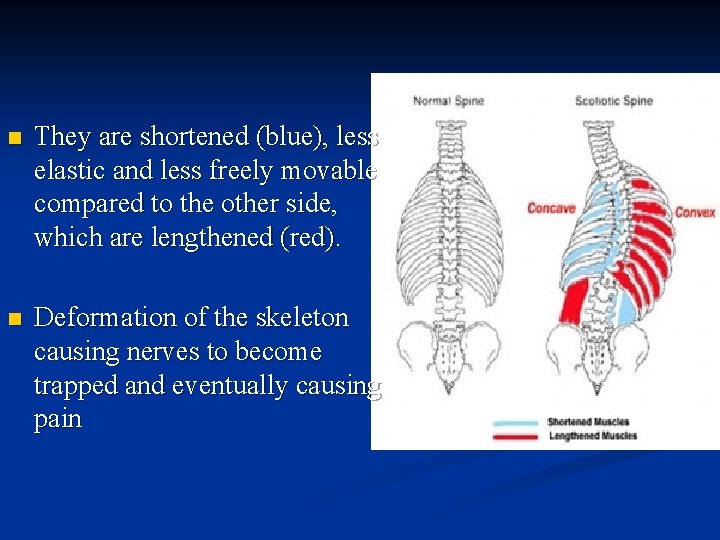  n They are shortened (blue), less elastic and less freely movable compared to