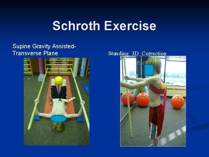 Schroth Exercise Supine Gravity Assisted. Transverse Plane Standing 3 D Correction 