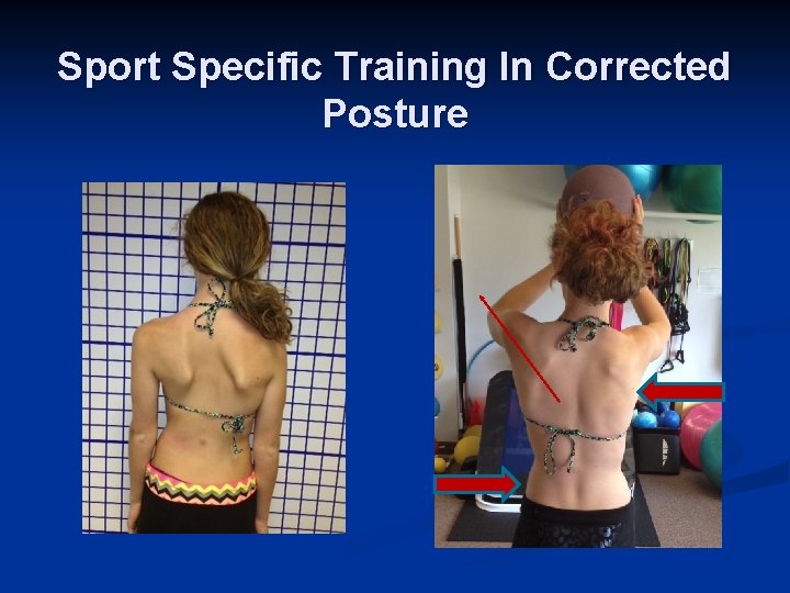 Sport Specific Training In Corrected Posture 