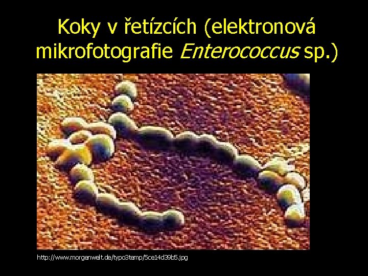 Koky v řetízcích (elektronová mikrofotografie Enterococcus sp. ) http: //www. morgenwelt. de/typo 3 temp/5