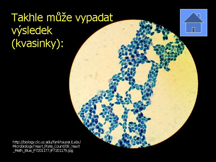 Takhle může vypadat výsledek (kvasinky): http: //biology. clc. uc. edu/fankhauser/Labs/ Microbiology/Yeast_Plate_Count/09_Yeast _Meth_Blue_P 7201177. j.