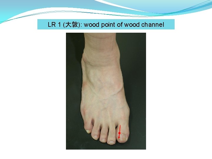 LR 1 (大敦): wood point of wood channel 