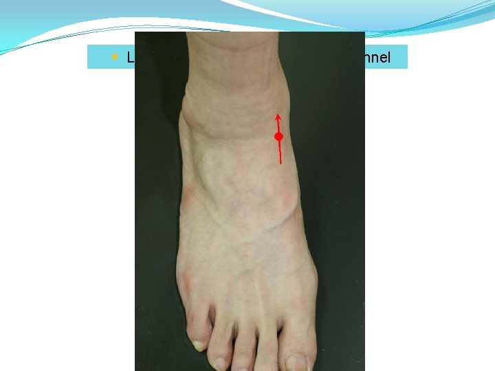 § LR 4 (中封): metal point of liver channel 