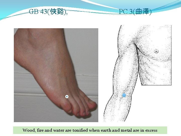 GB 43(俠谿), PC 3(曲澤) Wood, fire and water are tonified when earth and metal