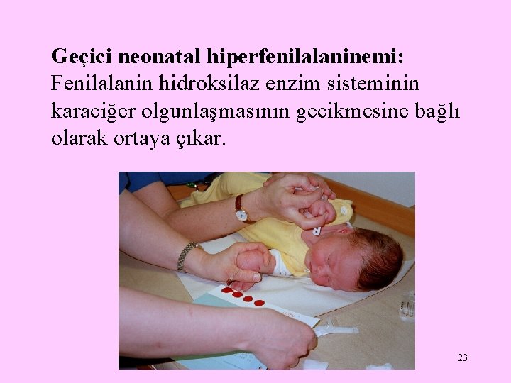 Geçici neonatal hiperfenilalaninemi: Fenilalanin hidroksilaz enzim sisteminin karaciğer olgunlaşmasının gecikmesine bağlı olarak ortaya çıkar.