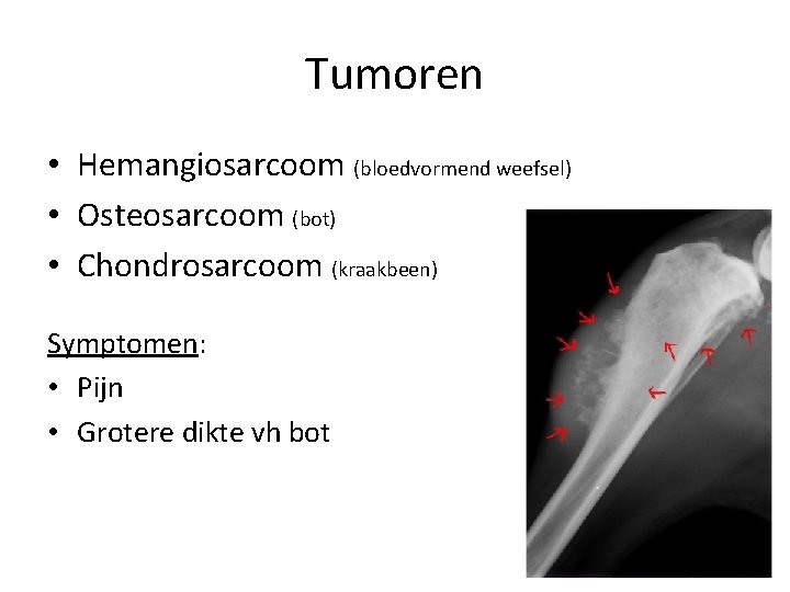 Tumoren • Hemangiosarcoom (bloedvormend weefsel) • Osteosarcoom (bot) • Chondrosarcoom (kraakbeen) Symptomen: • Pijn