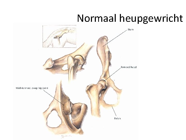Normaal heupgewricht 