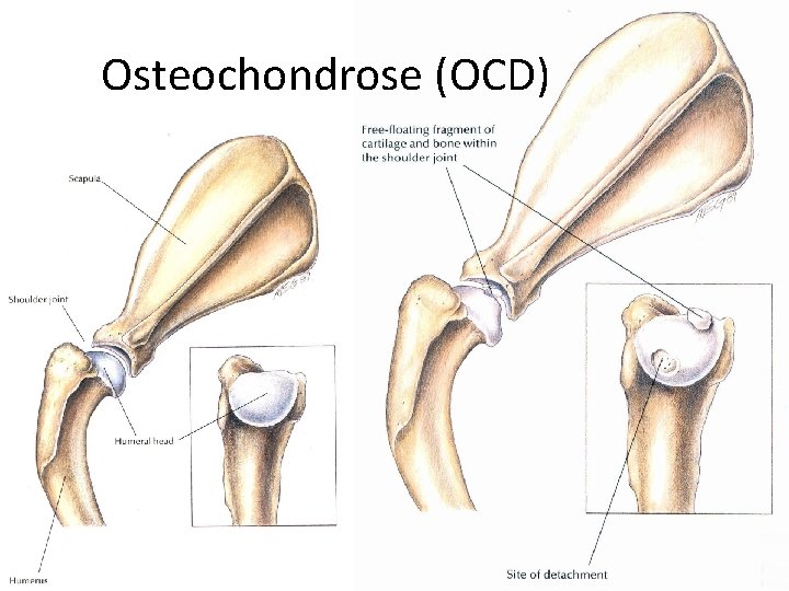Osteochondrose (OCD) 