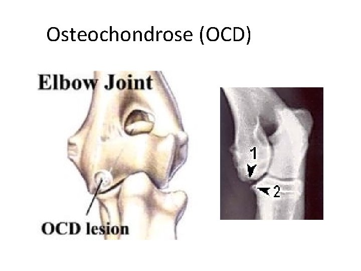 Osteochondrose (OCD) 