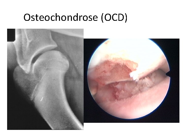 Osteochondrose (OCD) 