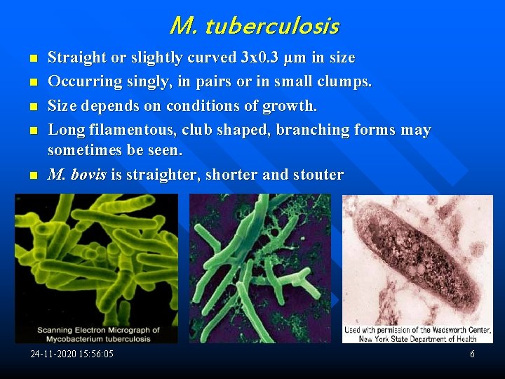 M. tuberculosis n n n Straight or slightly curved 3 x 0. 3 μm