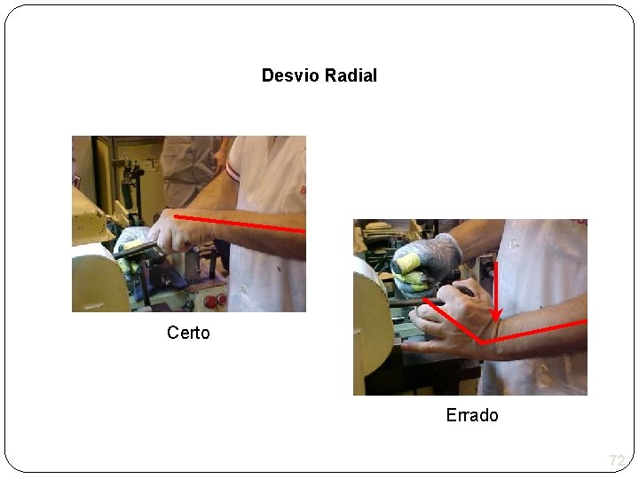 Desvio Radial Certo Errado 72 