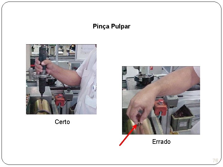 Pinça Pulpar Certo Errado 76 
