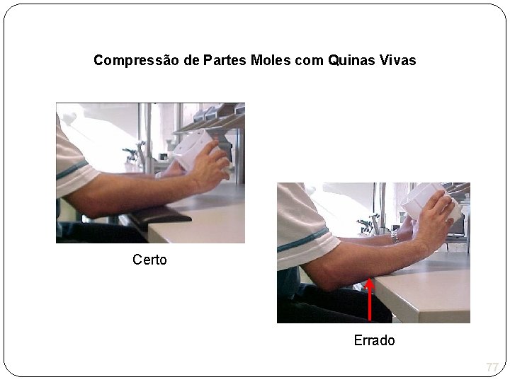 Compressão de Partes Moles com Quinas Vivas Certo Errado 77 