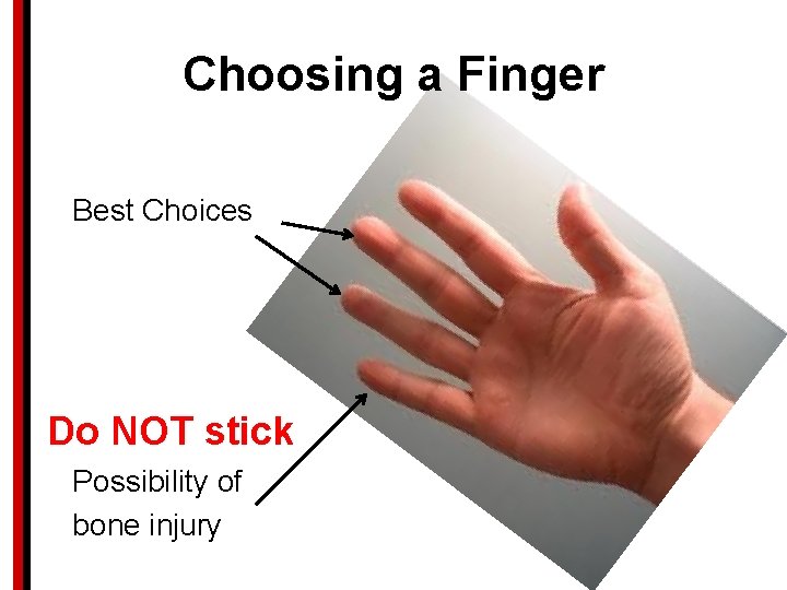 Choosing a Finger Best Choices Do NOT stick Possibility of bone injury 