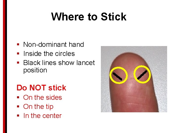 Where to Stick § Non-dominant hand § Inside the circles § Black lines show