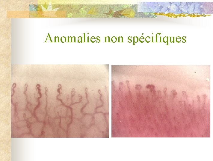 Anomalies non spécifiques 