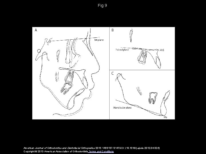 Fig 9 American Journal of Orthodontics and Dentofacial Orthopedics 2013 143 S 137 -S