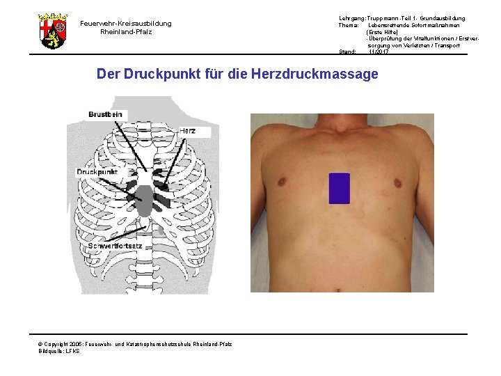 Feuerwehr-Kreisausbildung Rheinland-Pfalz Lehrgang: Truppmann -Teil 1 - Grundausbildung Thema: Lebensrettende Sofortmaßnahmen (Erste Hilfe) -Überprüfung Feuerwehr-Kreisausbildung Rheinland-Pfalz Lehrgang: Truppmann -Teil 1 - Grundausbildung Thema: Lebensrettende Sofortmaßnahmen (Erste Hilfe) -Überprüfung