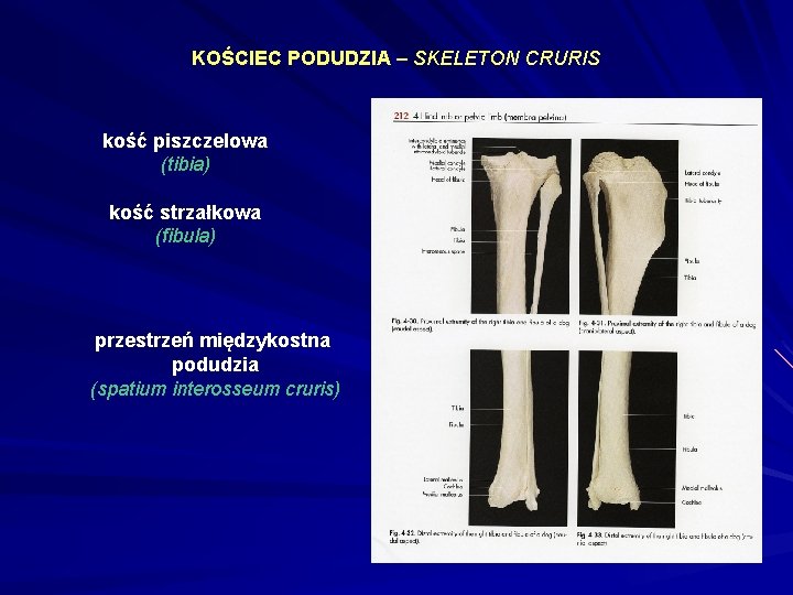 KOŚCIEC PODUDZIA – SKELETON CRURIS kość piszczelowa (tibia) kość strzałkowa (fibula) przestrzeń międzykostna podudzia
