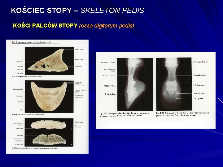 KOŚCIEC STOPY – SKELETON PEDIS KOŚCI PALCÓW STOPY (ossa digitorum pedis) 