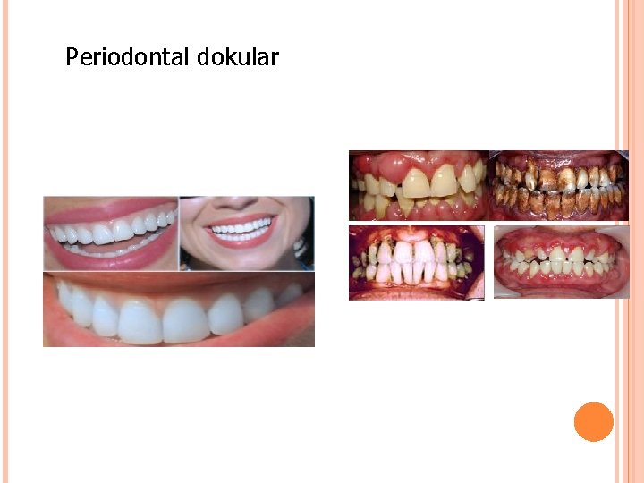 Periodontal dokular 