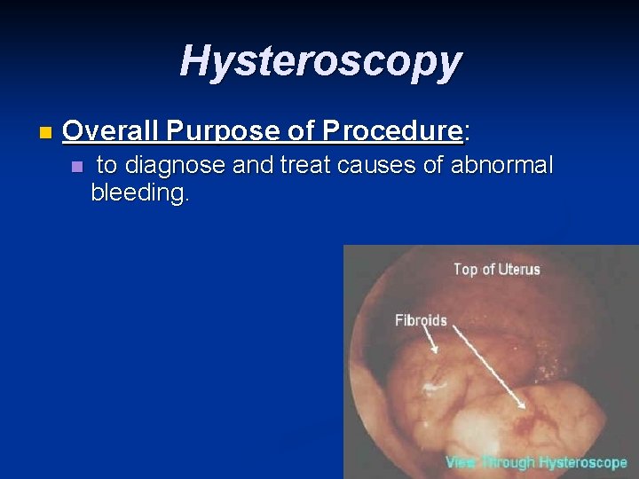 Hysteroscopy n Overall Purpose of Procedure: n to diagnose and treat causes of abnormal