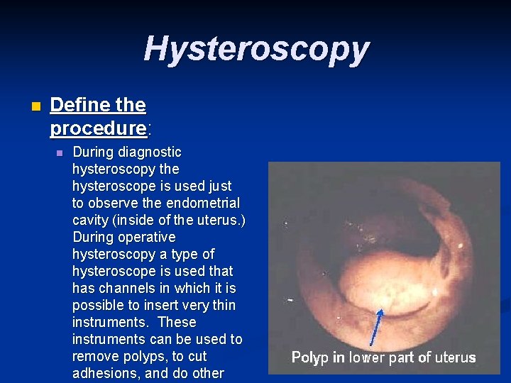 Hysteroscopy n Define the procedure: n During diagnostic hysteroscopy the hysteroscope is used just