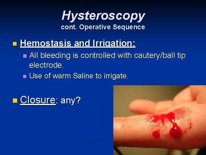 Hysteroscopy cont. Operative Sequence n Hemostasis and Irrigation: n All bleeding is controlled with