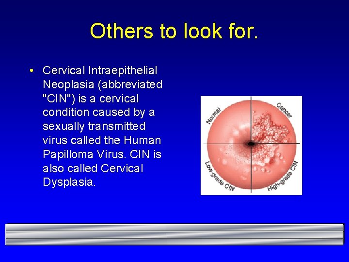 Others to look for. • Cervical Intraepithelial Neoplasia (abbreviated "CIN") is a cervical condition