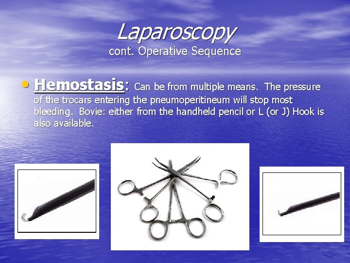 Laparoscopy cont. Operative Sequence • Hemostasis: Can be from multiple means. The pressure of