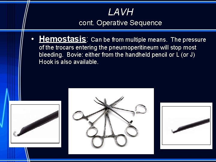 LAVH cont. Operative Sequence • Hemostasis: Can be from multiple means. The pressure of